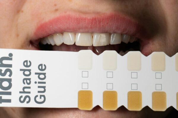 A chipped tooth at home
