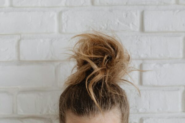 Hair breakage
