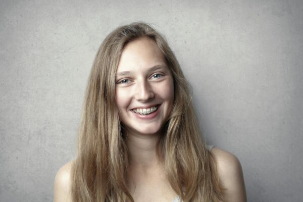 Underbite
